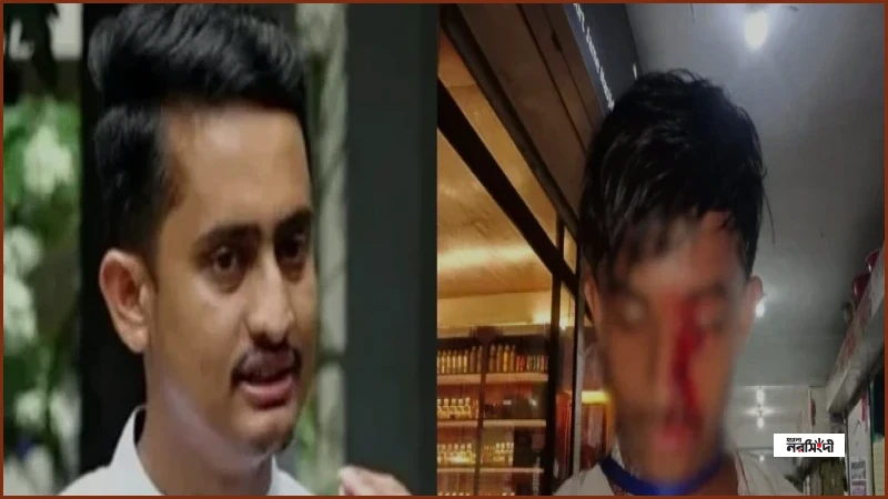 হবিগঞ্জে হামলায় এনসিপিকর্মী আলিফের চোখের দৃষ্টিশক্তি হারালেন