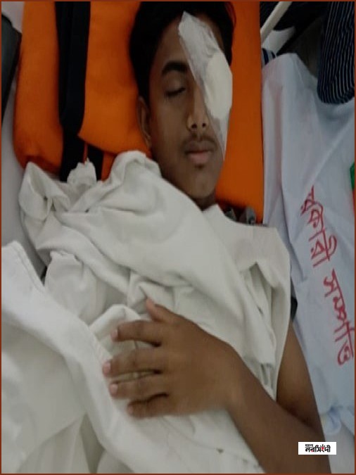 হবিগঞ্জে হামলায় গুরুতর আহত ছাত্রশক্তি নেতা আলিফের বাঁ চোখে অস্ত্রোপচার