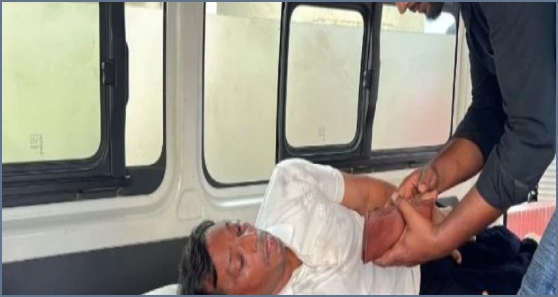 ঘুষ না দেওয়ায় ঠিকাদারের হাত ভাঙার অভিযোগ পৌর কর্মকর্তার বিরুদ্ধে