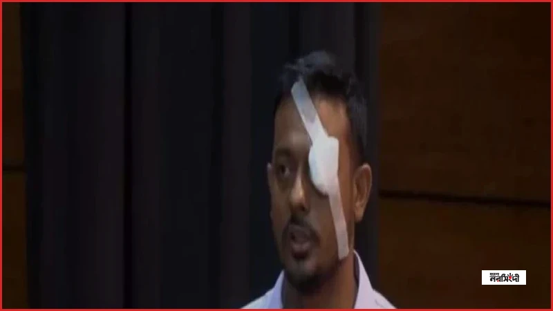 চোখে ব্যান্ডেজ নিয়ে কেন বক্তব্য দিলেন নাসীরুদ্দীন পাটওয়ারী