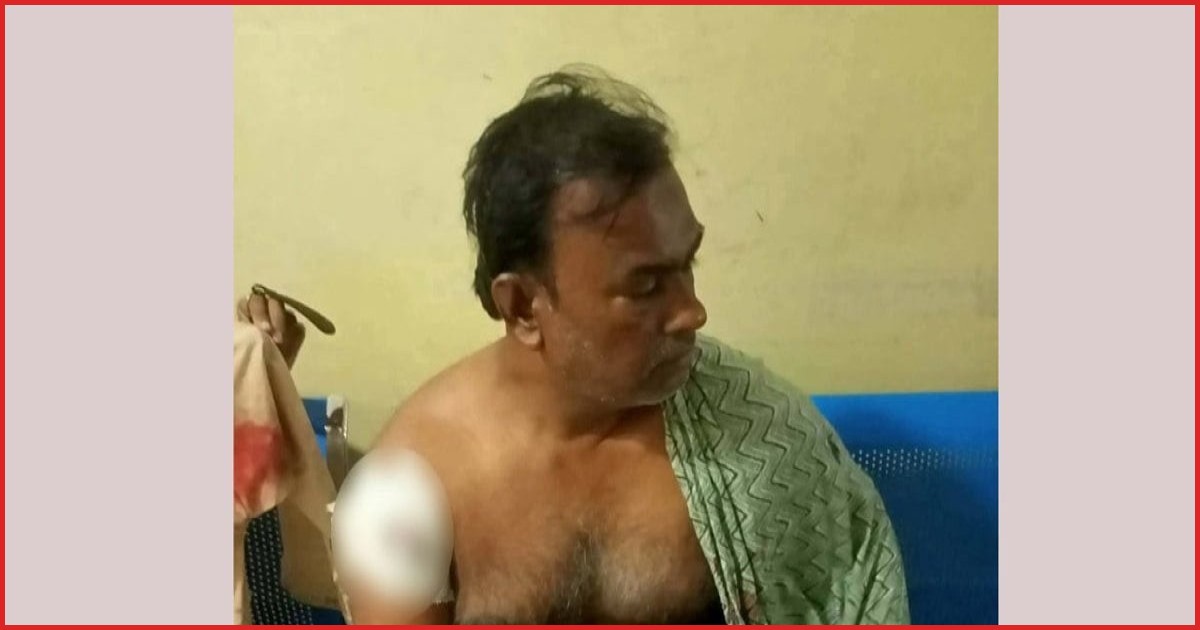 সন্দ্বীপে দোকানে ঢুকে ব্যবসায়ীকে গুলি, আহত অপর এক ব্যক্তি